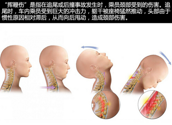 调节座椅头枕 有效避免“挥鞭伤”